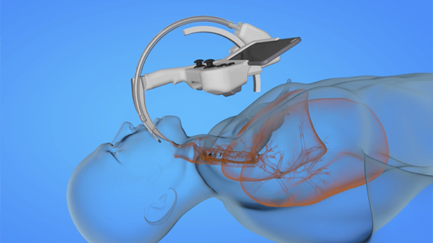 how2 Produktvideo 3D Medizin Aiendoscpic